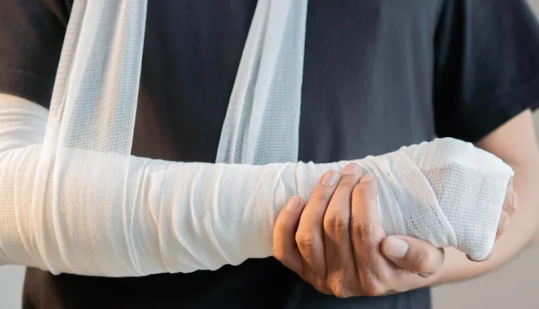 Person wearing a white arm cast and sling, holding the casted arm with the other hand.